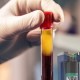 A medical professional holds a red-capped vial showing separated blood components used in traditional PRP and BMAC autologous therapy.