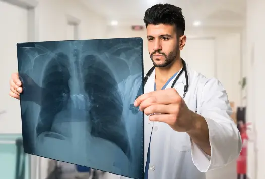 Doctor in a white coat examining a chest X-ray in a clinic, representing the direct medical costs of managing chronic conditions.