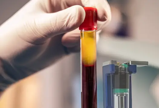Gloved hand holding a centrifuged blood vial with separated plasma, illustrating the science behind regenerative therapies.